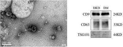 Urinary Exosomal MiRNA-4534 as a Novel Diagnostic Biomarker for Diabetic Kidney Disease